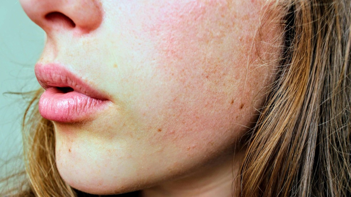 5 Everyday Mistakes That Destroy Your Skin