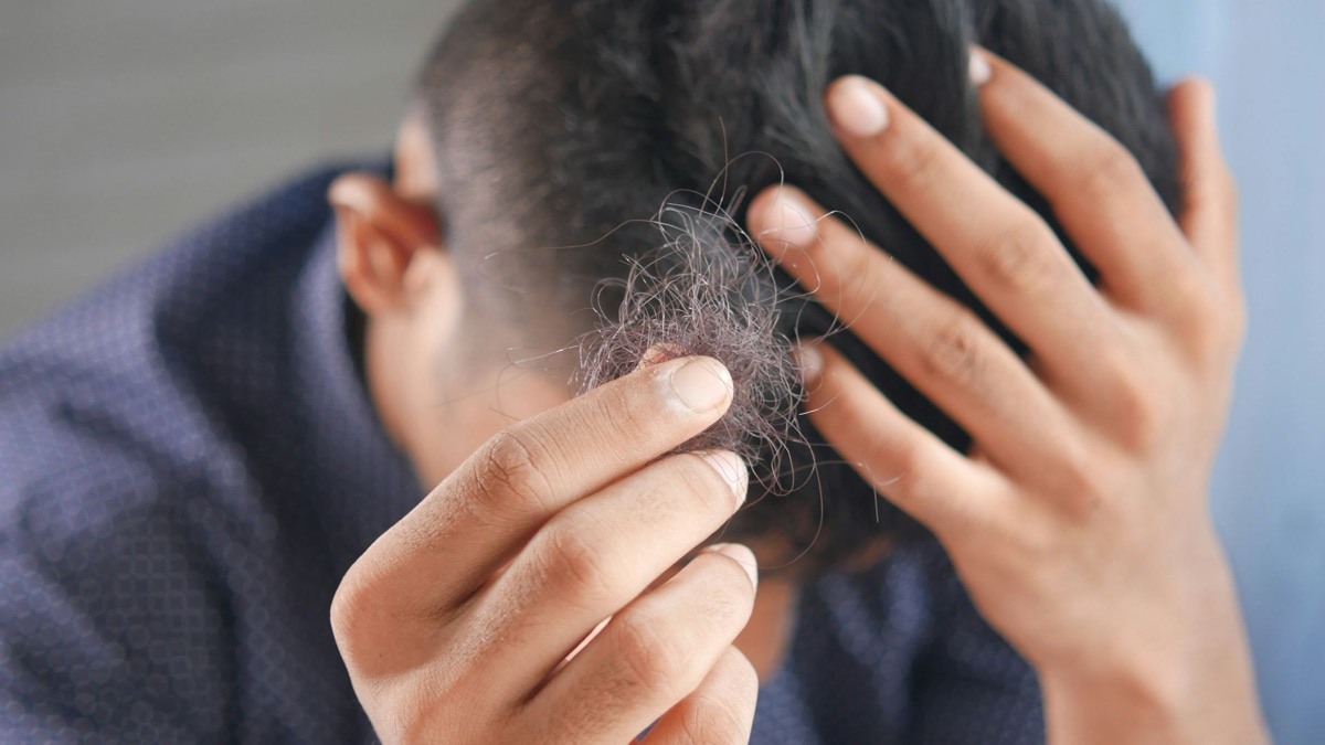 5 Reasons Your Hair Is Thinning